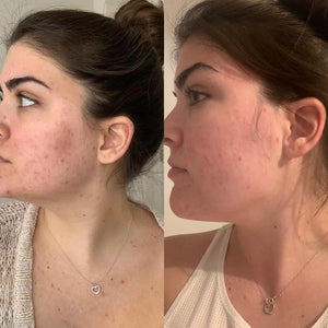 Clear Skin Kit